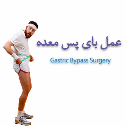 bypass surgery service sh هر آنچه در مورد جراحی لاغری باید بدانید