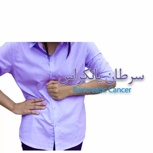 Pancreatic cancer عمل سرطان گوارش