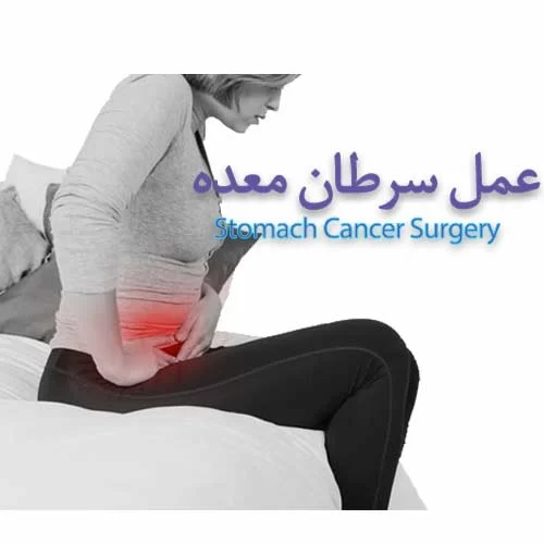 Stomach Cancer Surgery عمل سرطان گوارش