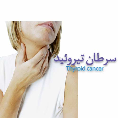 Thyroid cancer جراحی عمومی