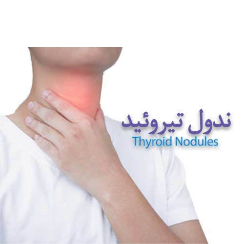 Thyroid nodules جراحی عمومی