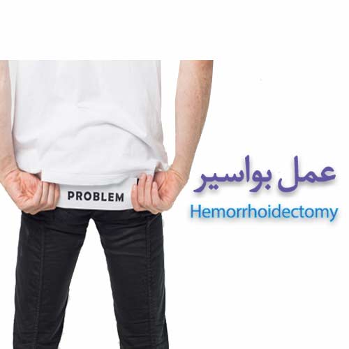 hemorrhoidectomy جراحی عمومی