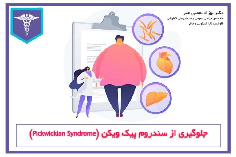 سند روم پیک ویکن یا بیماری هیپوونتیلاسیون چاقی