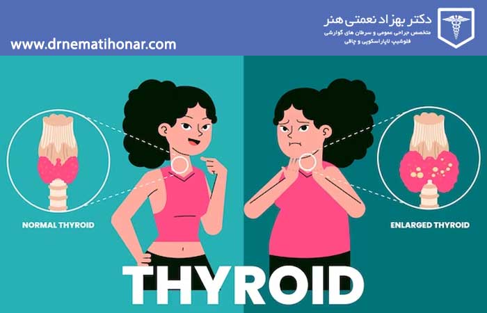 what is thyroied m معرفی غده تیروئید، اختلالات و روش های درمان